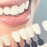 Cosmetic Dentistry Explained: Procedures, Costs, and Benefits