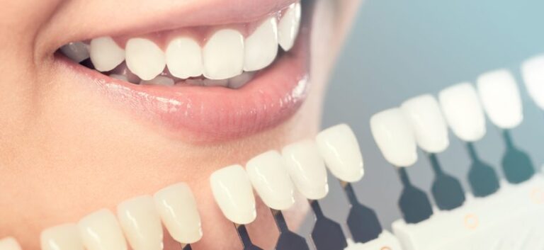 Cosmetic Dentistry Explained: Procedures, Costs, and Benefits
