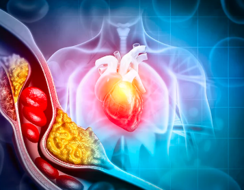 How to Lower Your Cholesterol Naturally