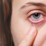 Eye Infections: Types, Causes, and Prevention Tips